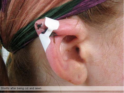 elf_ears_body_mod_0.jpg