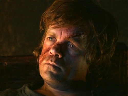Tyrion-scar.jpg